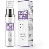 Dark Spot Remover for Face and Body,Dark Spot Corrector for Age Spots and Brown Spots,Advanced Formula with and Hyaluronic Acid and (1.7 Fl Oz (Pack of 1))