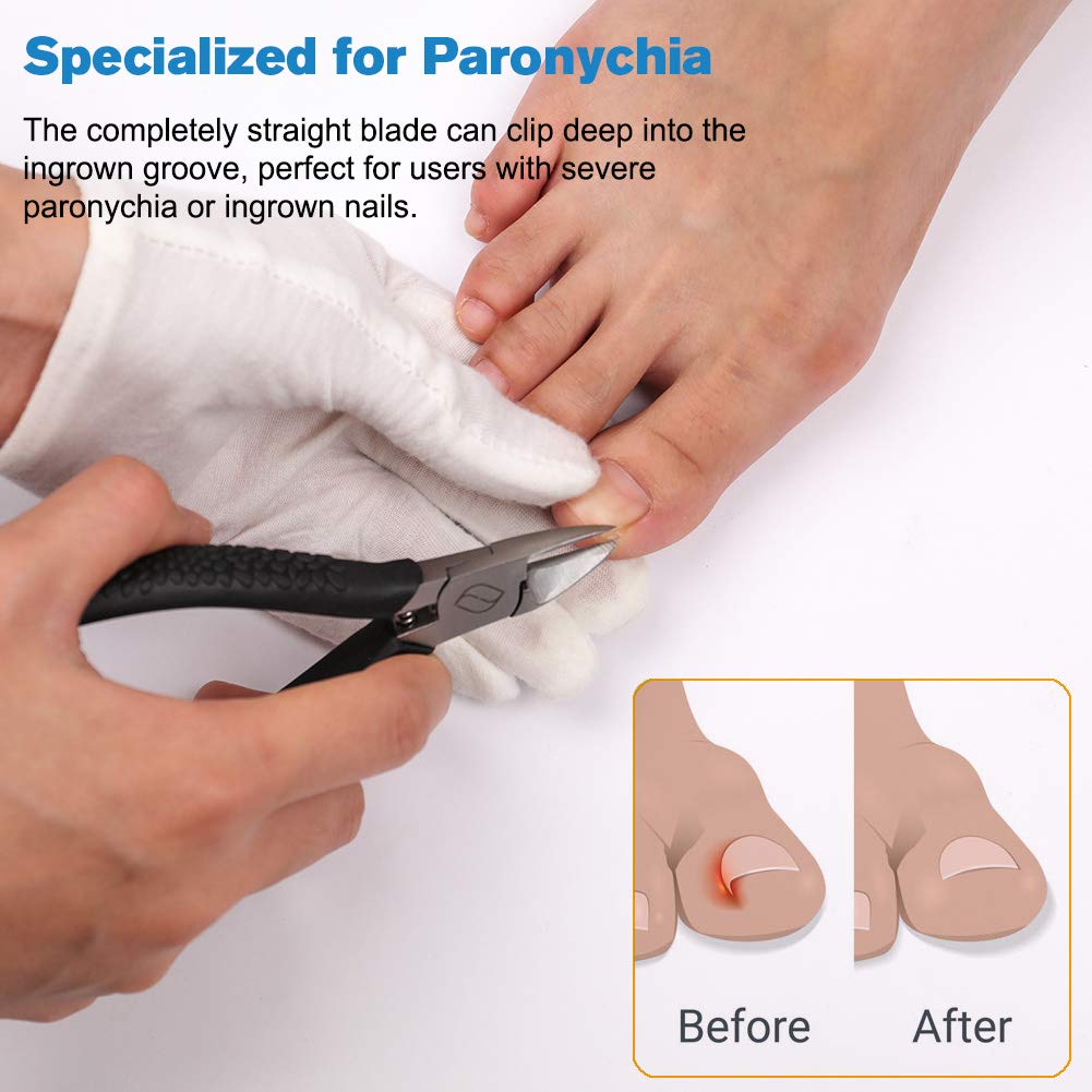 FERYES Straight Blade Toenail Clippers with Toenail Lifter and Fork - Podiatrist Toe Nail Clipper for Thick Toenails - 2 in 1 Ingrown Toenail Tools Kit: Beauty