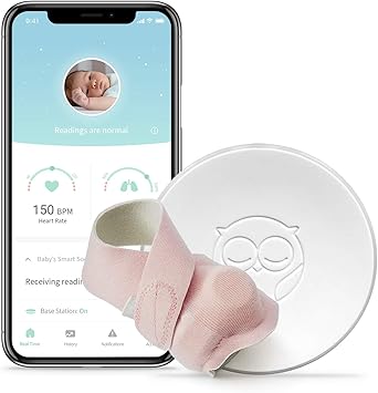 owlet smart sock burn