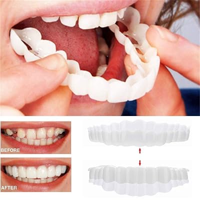 Snap On Smile - Instant Perfect Smile Clip On Veneers Top &amp;amp;amp; Bottom - Perfect Braces and Whitening Alternative No Pain No Shots No Drilling