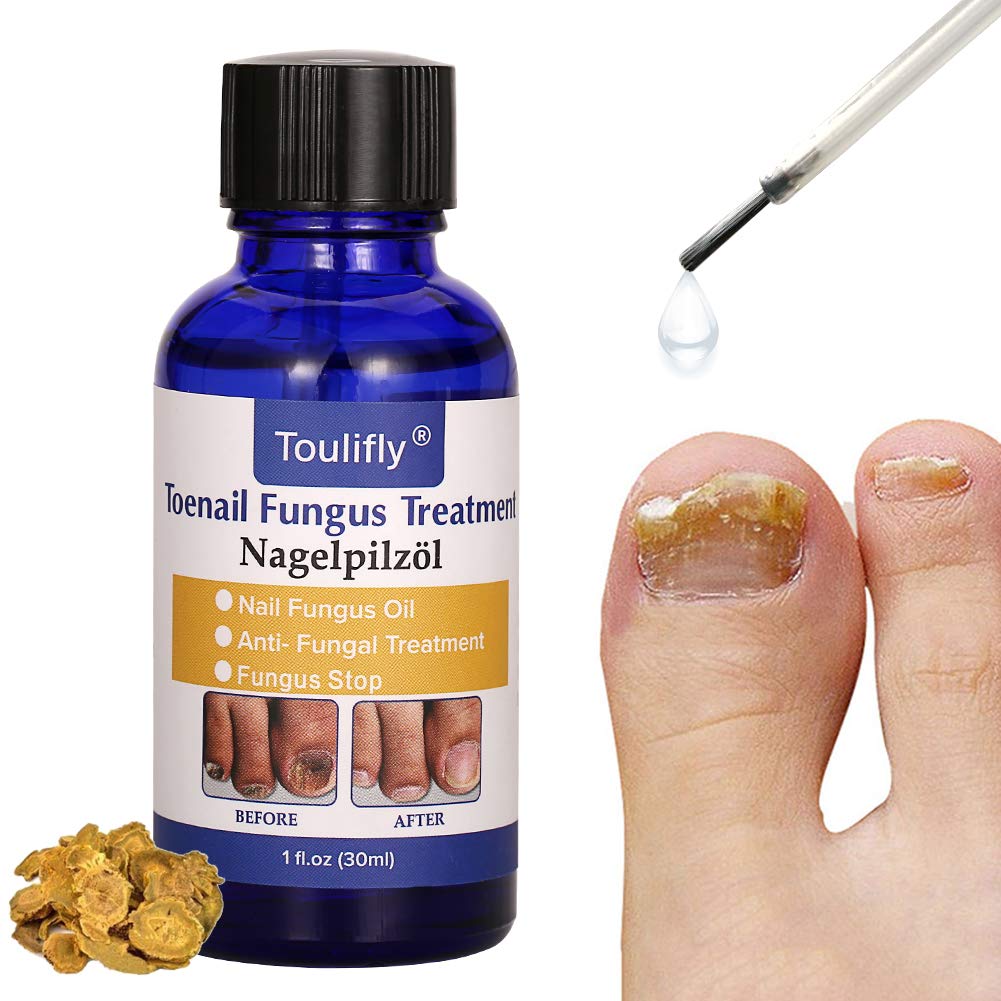 Nail Repair, Nail Solution, Natural Nail Treatment, Effective Against Nail Infection Restores Discolored & Damaged Nails : Beauty
