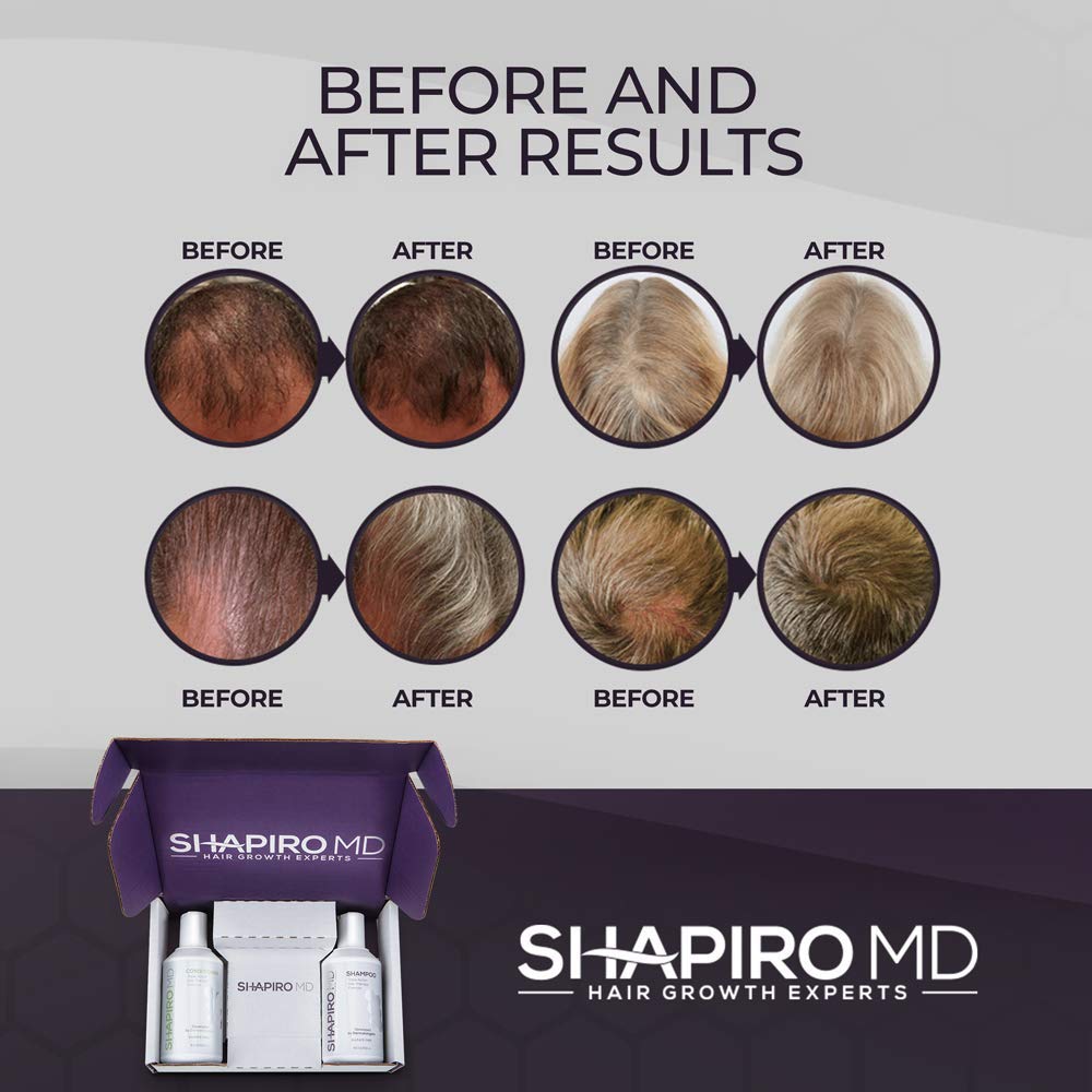 Hair Loss Shampoo | All-Natural Vegan Formula, DHT Blockers for Thinning Hair Developed by Dermatologists | Experience Healthier, Fuller and Thicker Looking Hair - Shapiro MD | 2-Month Hair Shampoo Supply: Beauty