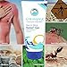 STREAM 2 SEA After Sun and Sting Relief Aloe Vera Soothing Gel For Sensitive Skin, 6 Fl oz Paraben Free Cooling Gel For Sting, Bug Bites and Sunburn Relief With Aloe Vera and Green Tea