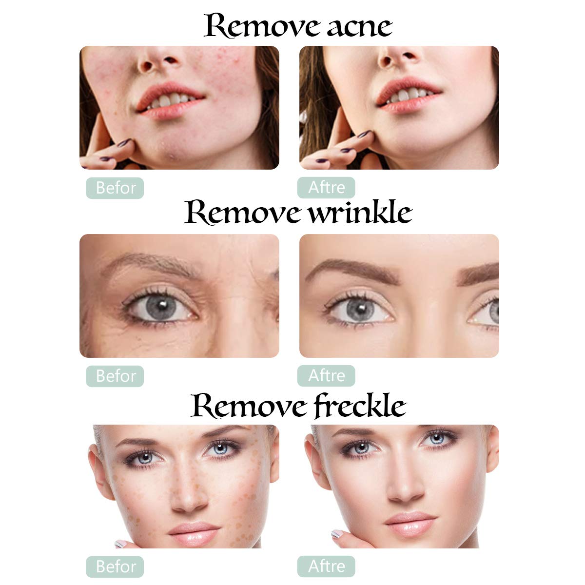 5 in 1 Diamond Microdermabrasion Machine, Yofuly Home Use Facial Skin Care Equipment: Beauty
