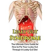 Leaky Gut Syndrome: The Ultimate Cure Guide for How to Fix Your Leaky Gut Through A Leaky Gut Diet (Leaky Gut Syndrome, Leaky