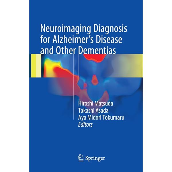 Imaging of Neurodegenerative Disorders: 9781604068542: Medicine