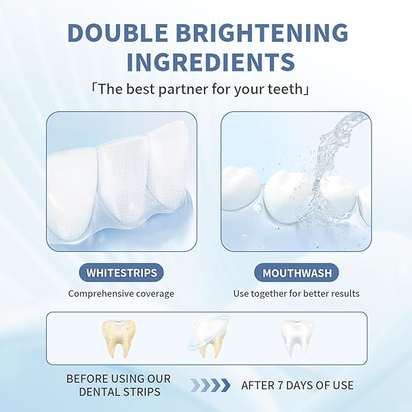 SOMALL 9D TEETH WHITENING STRIPS – 【NEWEST 2024】 PROFESSIONAL DENTAL FORMULA – ENAMEL SAFE WHITENING WITHOUT THE SENSITIVITY – 14 TREATMENTS WITH 28 STRIPS + MOUTHWASH GIVEN*14