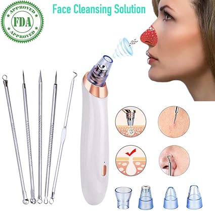 microdermabrasion for cystic acne