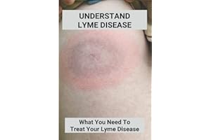 Understand Lyme Disease: What You Need To Treat Your Lyme Disease: Lyme Disease In Dogs Treatment