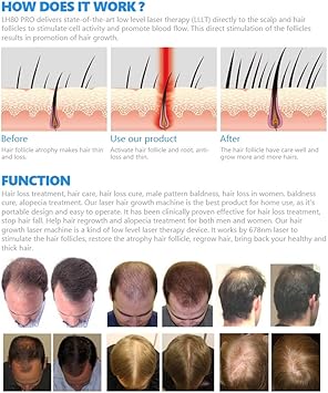 Amazon Com Meisheng Laser Hair Growth Helmet Laser Hair Growth