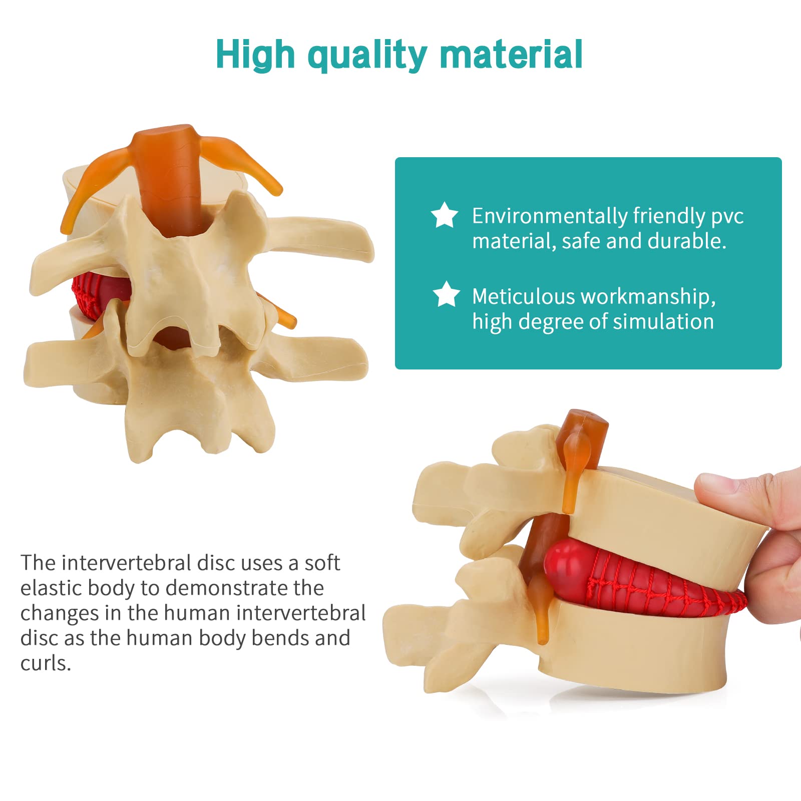 Disc Model Back Mua LVCHEN Disc Herniation Model - Human Lumbar Disc Herniation Spine ...