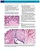 Atlas of Gynecologic Surgical Pathology: Expert Consult: Online and Print