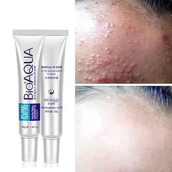 bioaqua freckle cream
