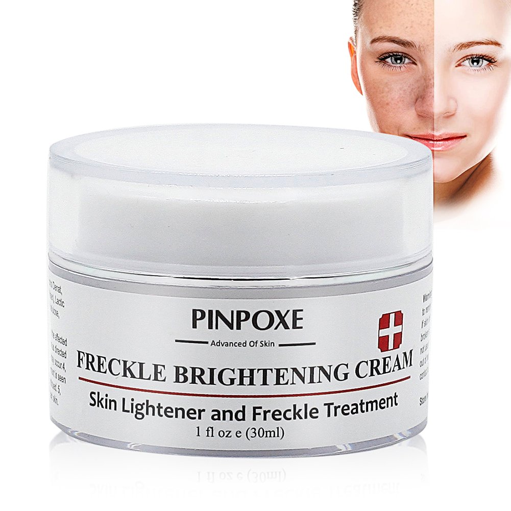 freckles treatment cream