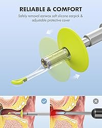 Anykit Digital Otoscope with Gyroscope, 4.5 Inches