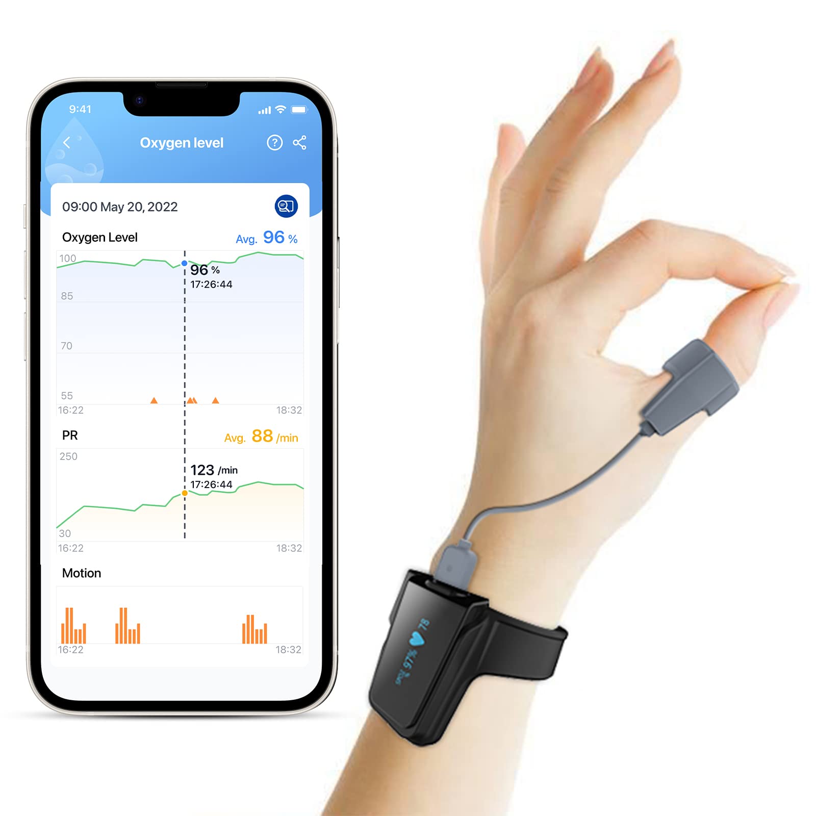 ViATOM Checkme O2 Sleep Pulse Oximeter, Blood Oxygen Monitor Finger and Wrist with Bluetooth, Wearable Sleep Monitor with Continuous Monitoring, Professional APP&PC Report