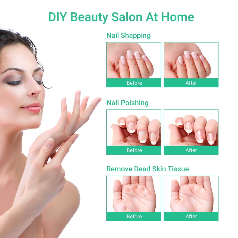 SEEKONE Electric Manicure and Pedicure Set, Professional Powerful Nail Drill Kit Salon Quality Nail File Tools for Foot and Hand Care with 7 Attachments, 5 Speed Settings and Storage Case (White) : Beauty