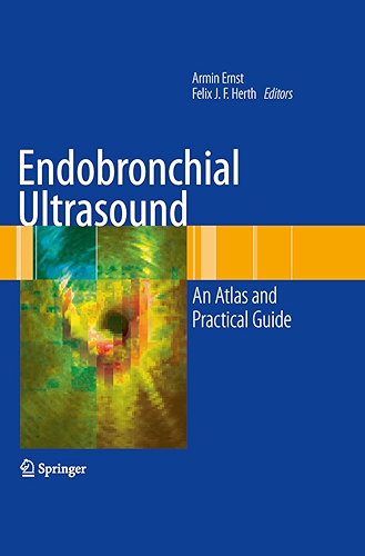 Download Endobronchial Ultrasound: An Atlas and Practical Guide (English Edition) PDF