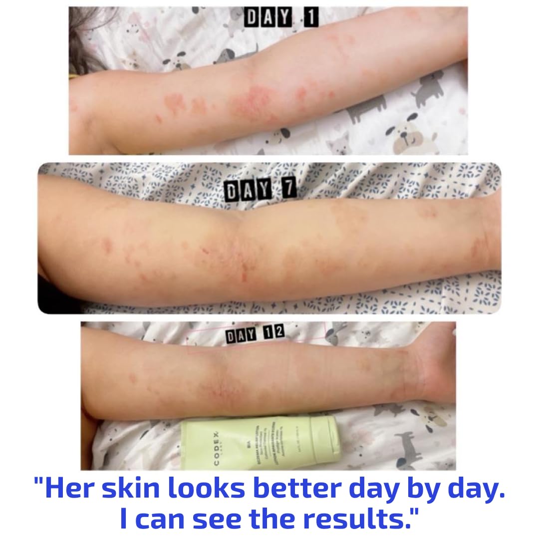 Codex Labs BIA Eczema Relief Lotion, 3.4 oz - Clinically Proven Colloidal Oatmeal 1% for Itchy Dry Eczema Prone Skin - Fragrance Free Moisturizer with BiaComplex 2.0 - Safe for Babies, Kids & Adults