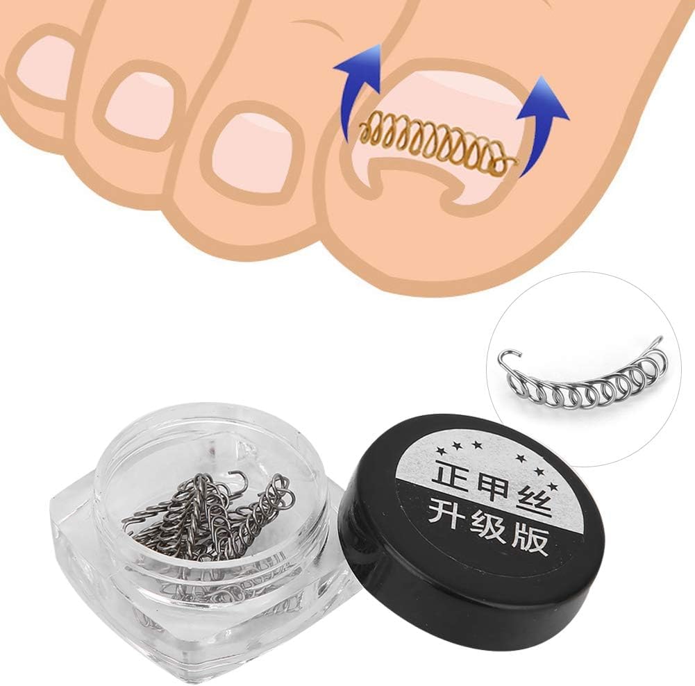 Ingrown Toe Wire Fixer, 2 Box Fixer Toenail Correction Corrector Lifter Tool Nail Ingrowing Pedicure Care with 6 Sizes for Nail Toe Straighteners Recover Foot Care Men and Women