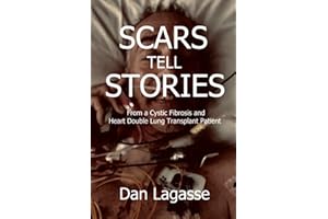 Scars Tell Stories: From a Cystic Fibrosis and Heart/Double Lung Transplant Patient