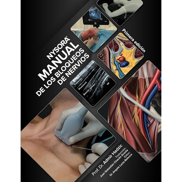 NYSORA Nerve Block Manual: First Edition (Regional Anesthesia