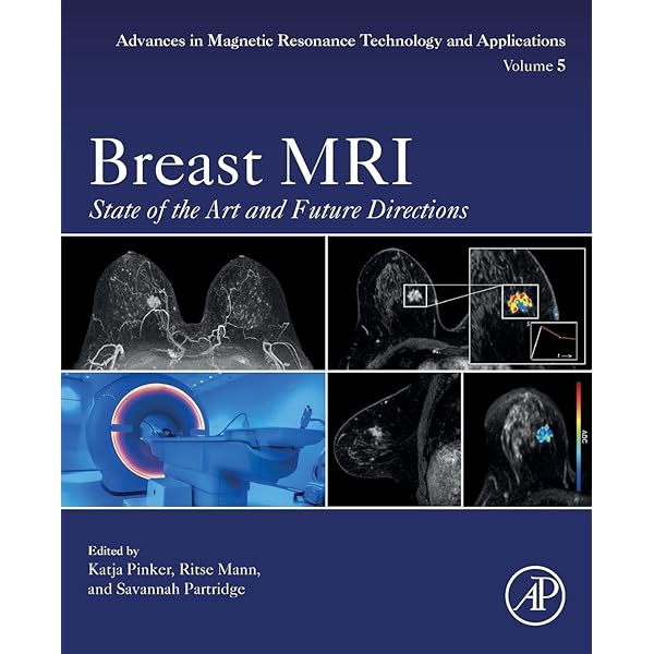 Amazon.com: Breast Ultrasound: 9780397516247: Stavros MD FACR, A