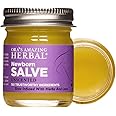 Newborn Salve, Baby Calendula Cream, Baby Acne Treatment, EWG Verified Baby Eczema Cream, Cradle Cap Treatment, Diaper Ointment, Natural Baby Care with Organic Calendula, Ora's Amazing Herbal