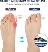 ACWOO Bunion Corrector Set for Women and Men with 2 Splints & 2 Toe view 4