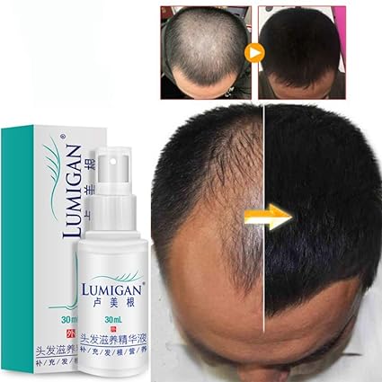 Amazon Com Taykoo 30ml Professional Anti Hair Loss Hair Growth