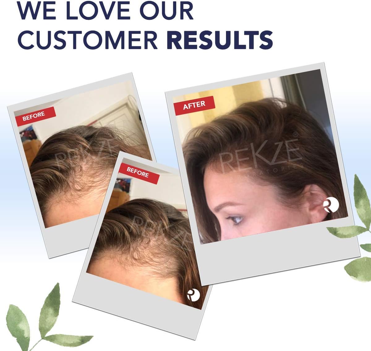 REKZE 24 Serum w/Unique Premium Clinically Proven Formula for Hair Thickening Anti-Hair Loss & Thinning - Image 5