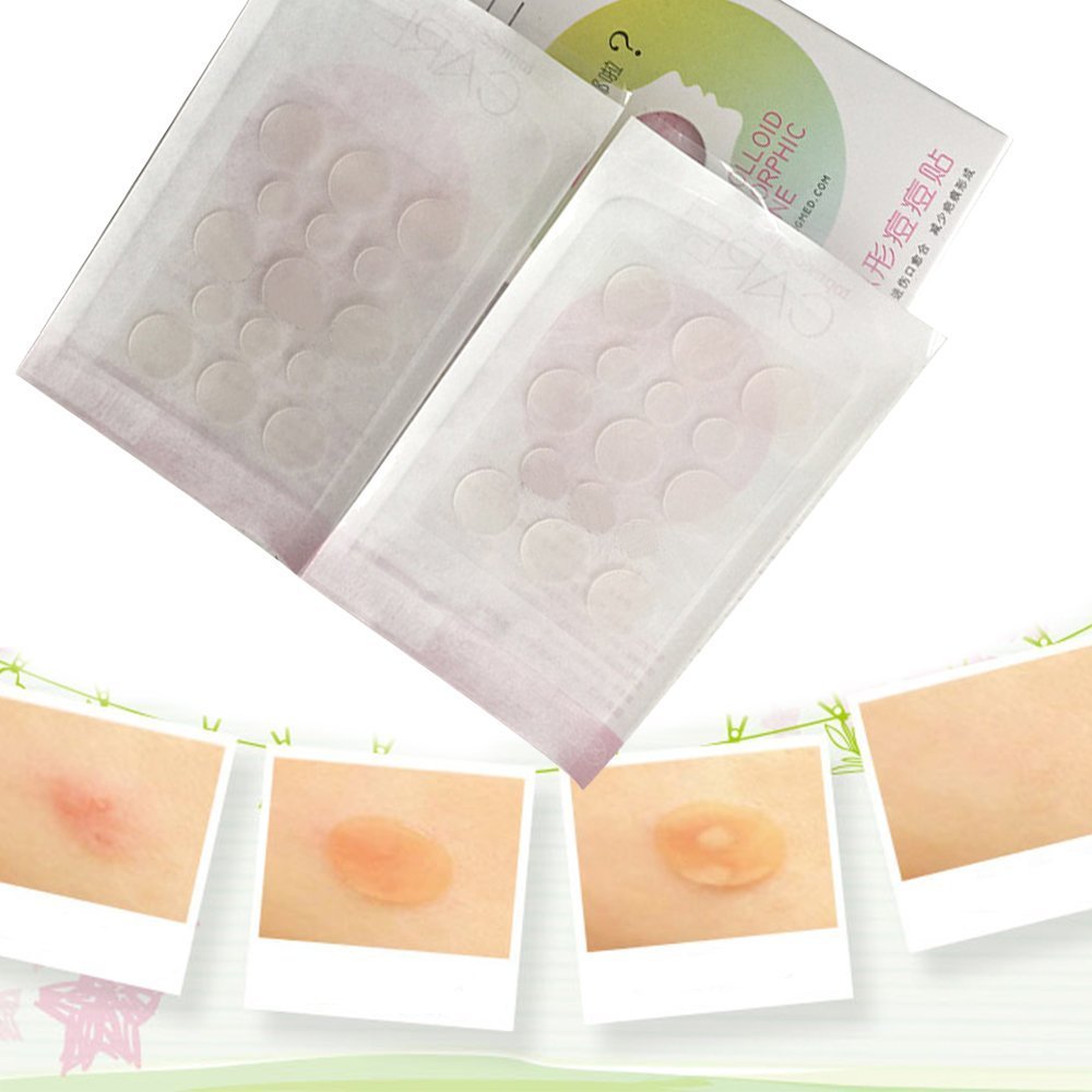 Travelmall Hydrokolloid Patches gegen Pickel Akne und Travelmall Hydrokolloid Patches gegen Pickel Akne und Hautunreinheiten 30 Stück in 2 Größen Amazon Beauty