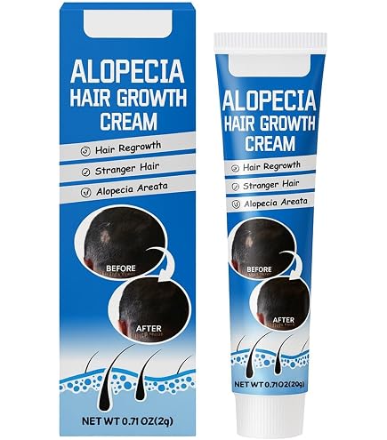 Amazon.com : ALOPECIA Amazing Hair Growth with Biotin 4oz : Beauty