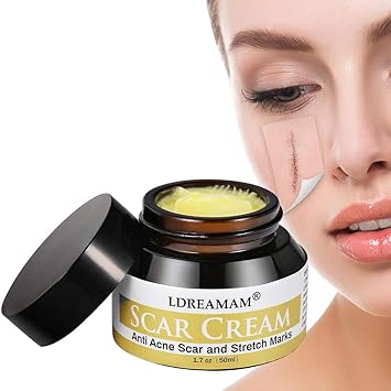 body cream for acne scars