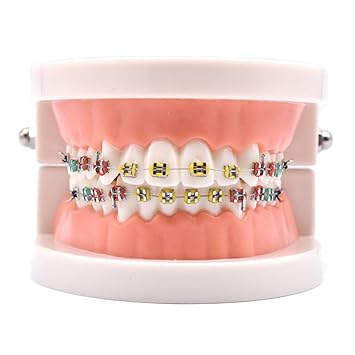 Download Amazon Com Angzhili Dental Orthodontic Demonstration Model For iPhone Free Get Wallpaper Amazon Com Angzhili Dental Orthodontic Demonstration Model For Android Free