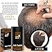 Art Naturals Hair Fusion - Hair Building Fibers 25 Grams to fill Thinning, Sparse or Balding Areas - Made of natural, colored Keratin Fibers that blend undetectable into existing hair …