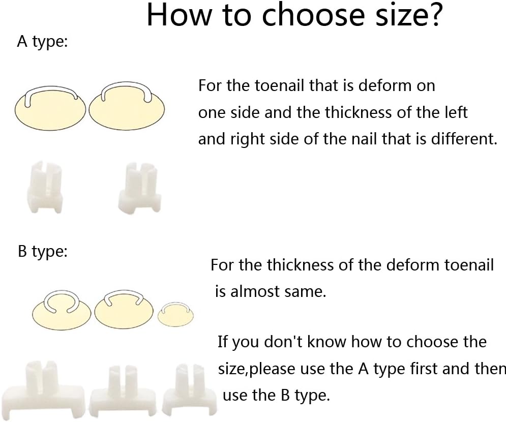 Professional Stainless Steel Ingrown Toe Nail Correction Tool Pedicure Tool: Health & Personal Care