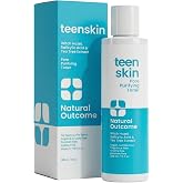 Acne Clarifying Face Toner for Teens by Natural Outcome Skin Care - Salicylic Acid Facial Astringent to Clear Acne &amp; Purify Pores - Fragrance Free, Alcohol Free 6.7 oz