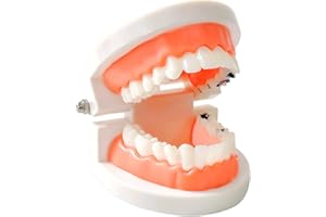 Dental Caries Teaching Model 1:1 Adult Life Size - Non-Removable Teeth Model for Education - Ideal for Demonstrations and Lea