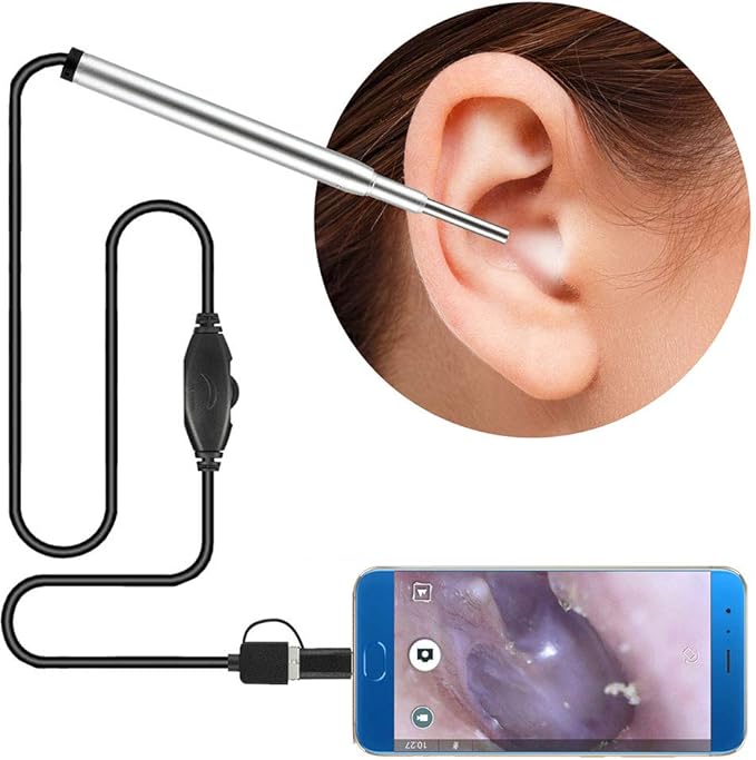 YUOCEAN Digital Ear Otoscope Endoscope Ear Cleaner Ear