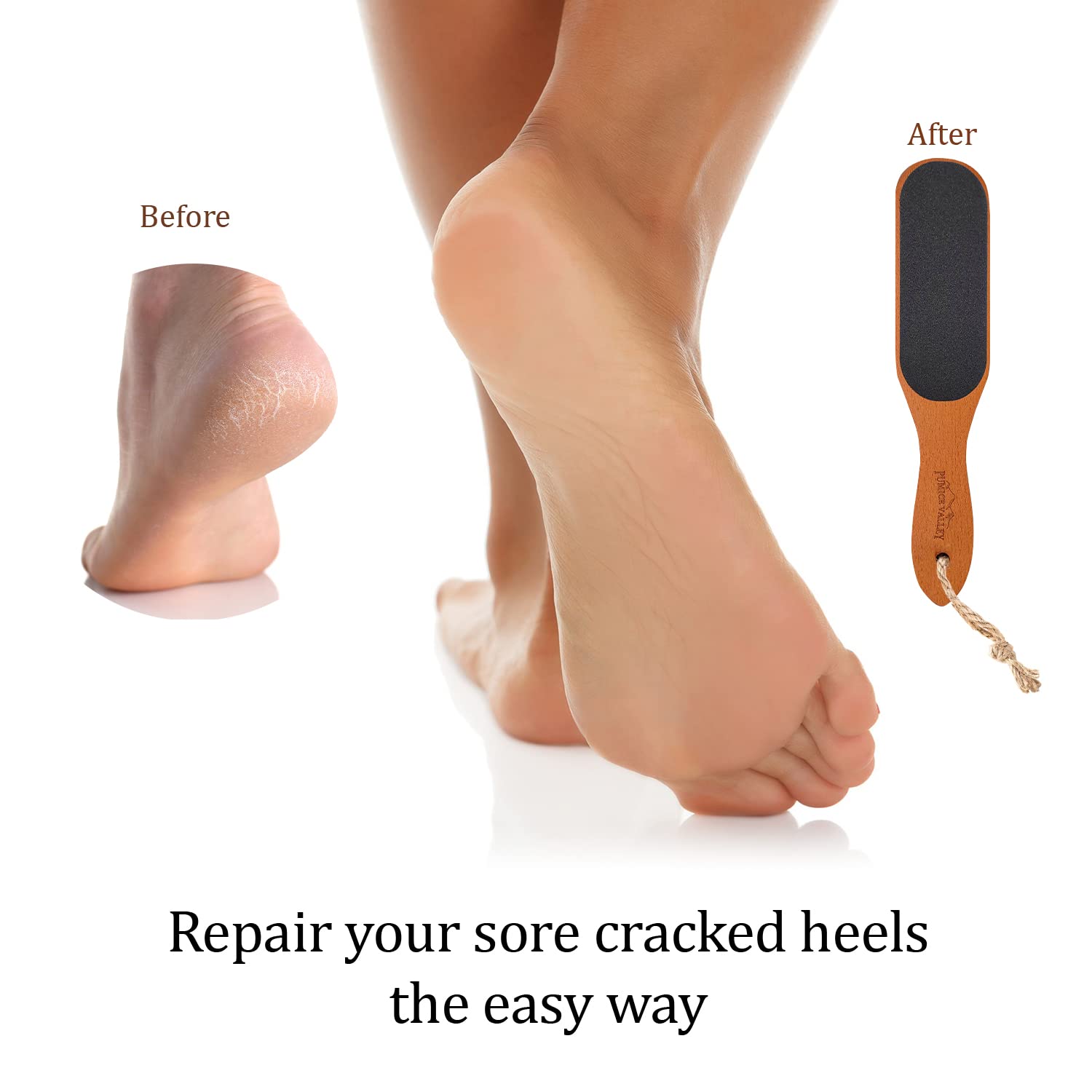 Pumice Stone Foot File - Wooden Pedicure Feet Scrubber with Handle for Callus, Dry, and Dead Skin Removal - Heel Scraper for Feet, Hands, and Body - Foot Filer for Use in Shower