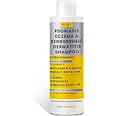 Antifungal Psoriasis Shampoo, Eczema, Seborrheic Dermatitis Shampoo | Soothes Itching, Flaking & Irritation | Repairs Scalp, Strengthens Hair, Stimulates Regrowth | Medicated Scalp Treatment