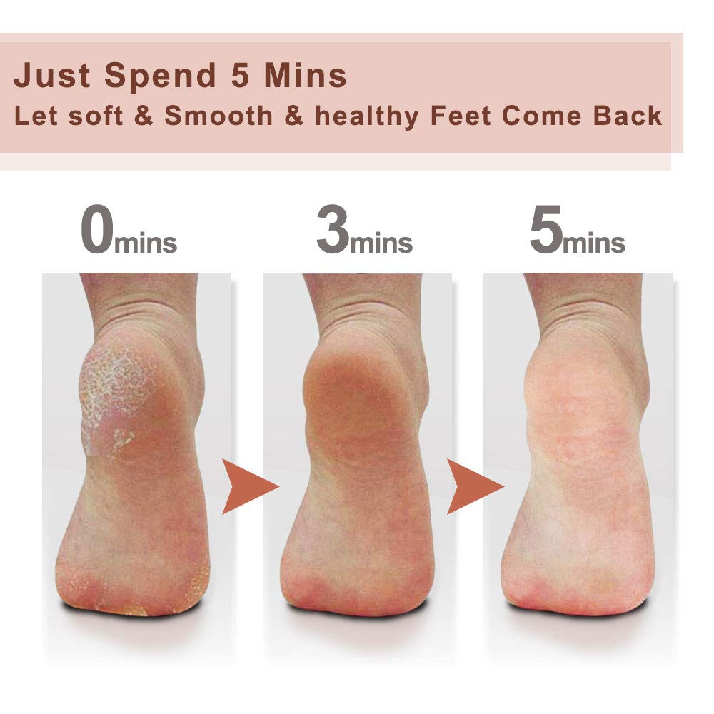 Colossal Innovative Nano Glass Callus Remover Foot File - Coarse Foot Rasp Colossal Foot Scrubber Salon Home Pedicure Foot Care Tool for Soft Feet (1PC): Health & Personal Care