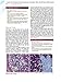 Diagnostic Immunohistochemistry: Theranostic and Genomic Applications, Expert Consult: Online and Print, 4e