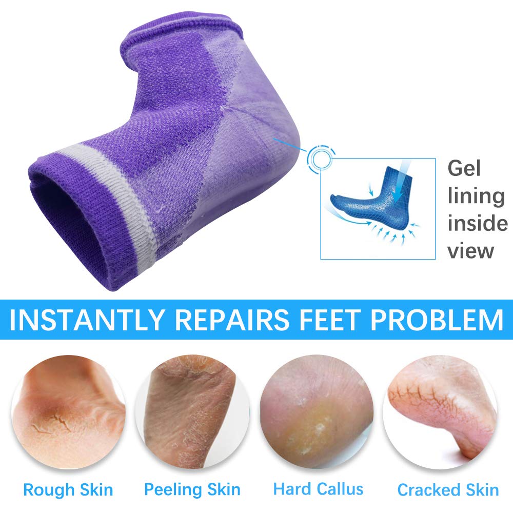 Moisturizing Socks, 3 Pairs-Moisturizing/Gel Heel Socks for Dry Cracked Heels, Open Toe Socks, Ventilate Gel Spa Socks to Heal and Treat Dry, Gel Lining Infused with Vitamins (Blue, Purple, Black) : Beauty