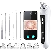 Blackhead Remover Vacuum, USB Interface Type Pore Vacuum, Black Head Extractions Tool with Camera for Men and Women Pore Cleaner, 3 Adjustment Modes & 6 Suction Heads(Black)