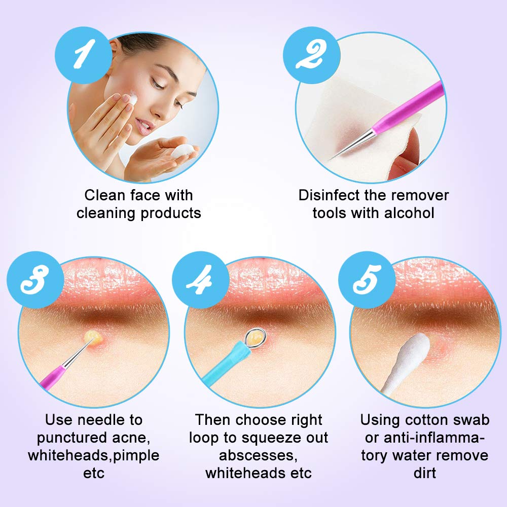 Blackhead Remover Tool Kit, Aooeou 10 Pcs Professional Pimple Popper Tool -Treatment for Pimples, Blackheads, Blemish, Zit Removing, Forehead and Nose(Colorful): Beauty