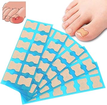 Patch De Baton D Ongle Incarne 4 Tailles Fichier De Correction D Ongle D Orteil Sans Colle Patch Correcteur De Paronychie Soin Des Pieds Traitement Outil De Pedicure 2 Amazon Fr Beaute Et Parfum