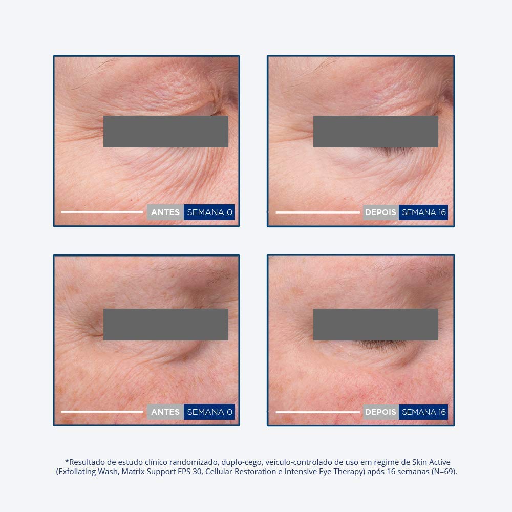 neostrata intensive eye cream