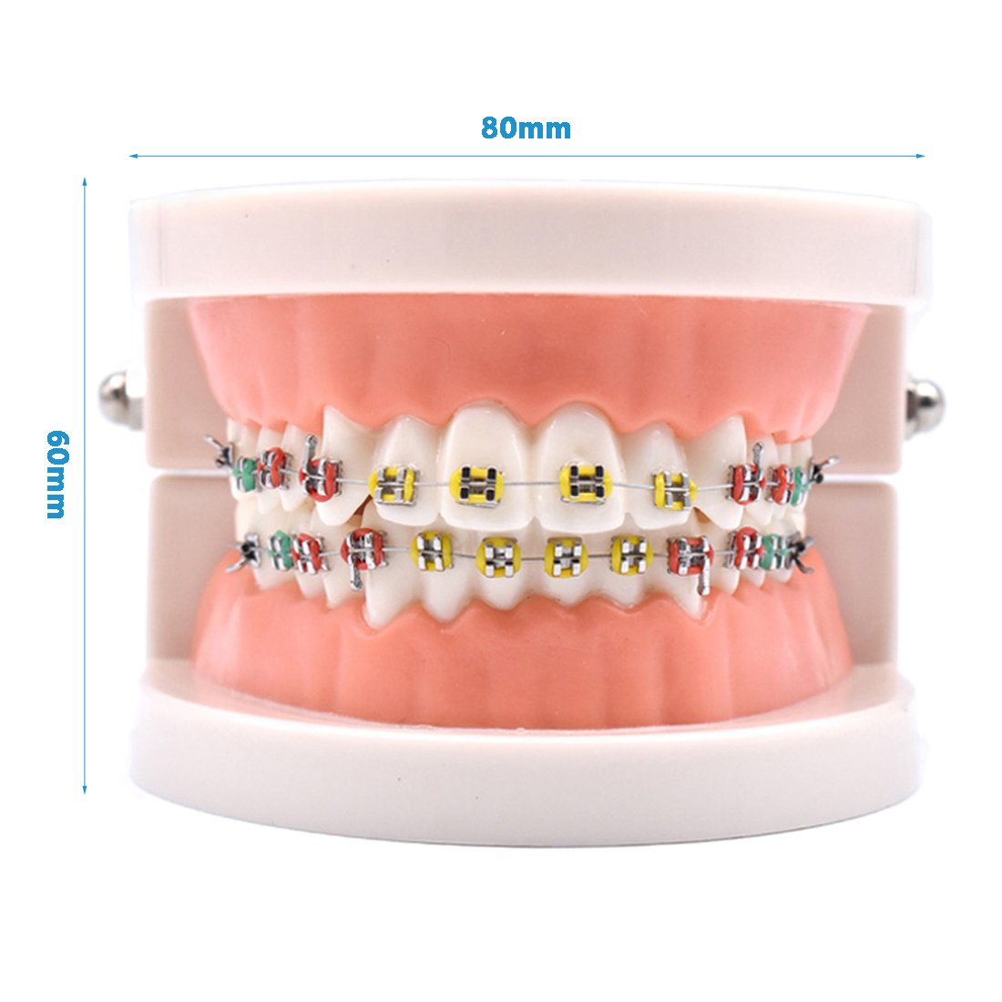 Angzhili Dental Orthodontic Demonstration Model Treatment